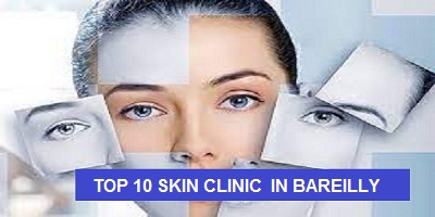 Top 10 Skin Clinic in Bareilly